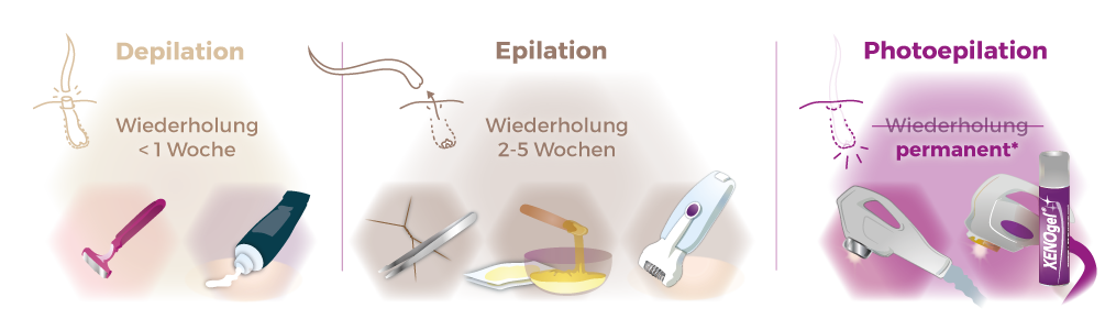 Illustration Methodenvergleich